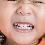 علل و درمان دندان قروچه در کودکان