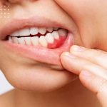 آگاهی از بیماری پریودنتال و ارتباط آن با سلامت قلب