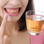 اثرات نوشیدنی‌های کافئین‌دار بر مینای دندان