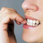 اثرات جویدن ناخن بر مینای دندان و ساختار دندان