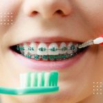 عوارض جانبی احتمالی محصولات سفید کننده خانگی